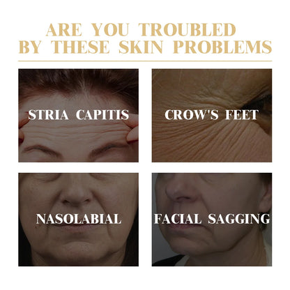 Collagen Mask 10PCS - Anti-Wrinkle & Hydrating